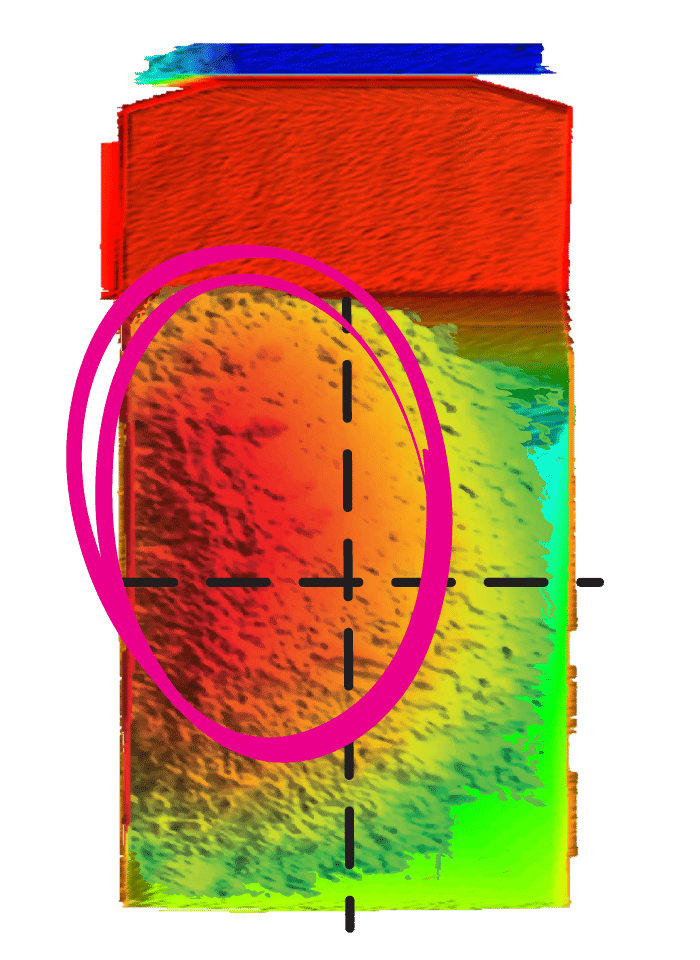 surface mining technology